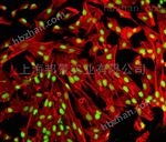 β2微球蛋白抗体（单抗）规格