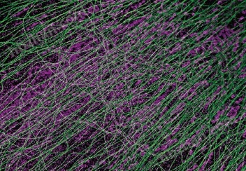 奧林巴斯顯微鏡