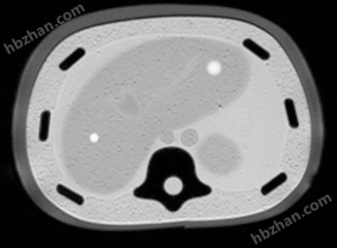 超聲檢查訓(xùn)練體模